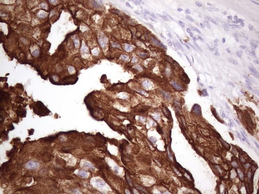 KRT16 / CK16 / Cytokeratin 16 Antibody (clone 7A4, Carrier-free)
