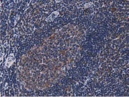 ACAT2 Antibody (clone OTI7B1)