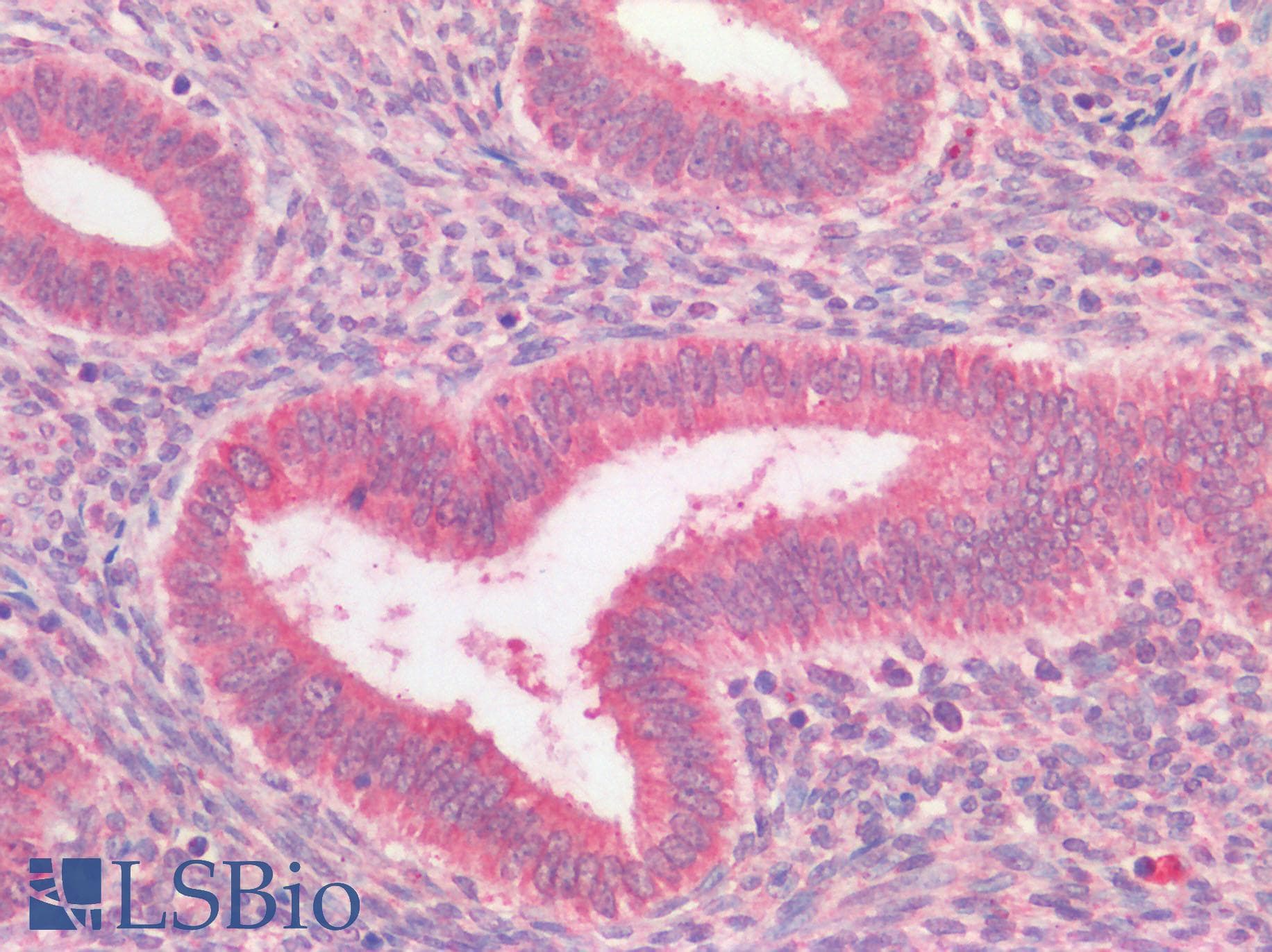 GPR49 / LGR5 Antibody (N-Terminus)