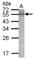Polyclonal Rabbit anti-Human Beta Galactosidase Antibody (WB)