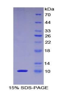 Human PKIA Protein (Recombinant His-T7)