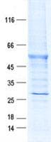 Human MAGEC2 / CT10 Protein (Recombinant DDK,C-terminus)
