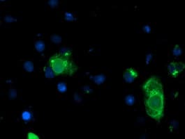 LPL / Lipoprotein Lipase Antibody (aa28-475, clone OTI6A10)