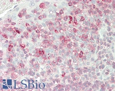 IHC-plus™ FKBP10 / FKBP65 Antibody (aa552-580)