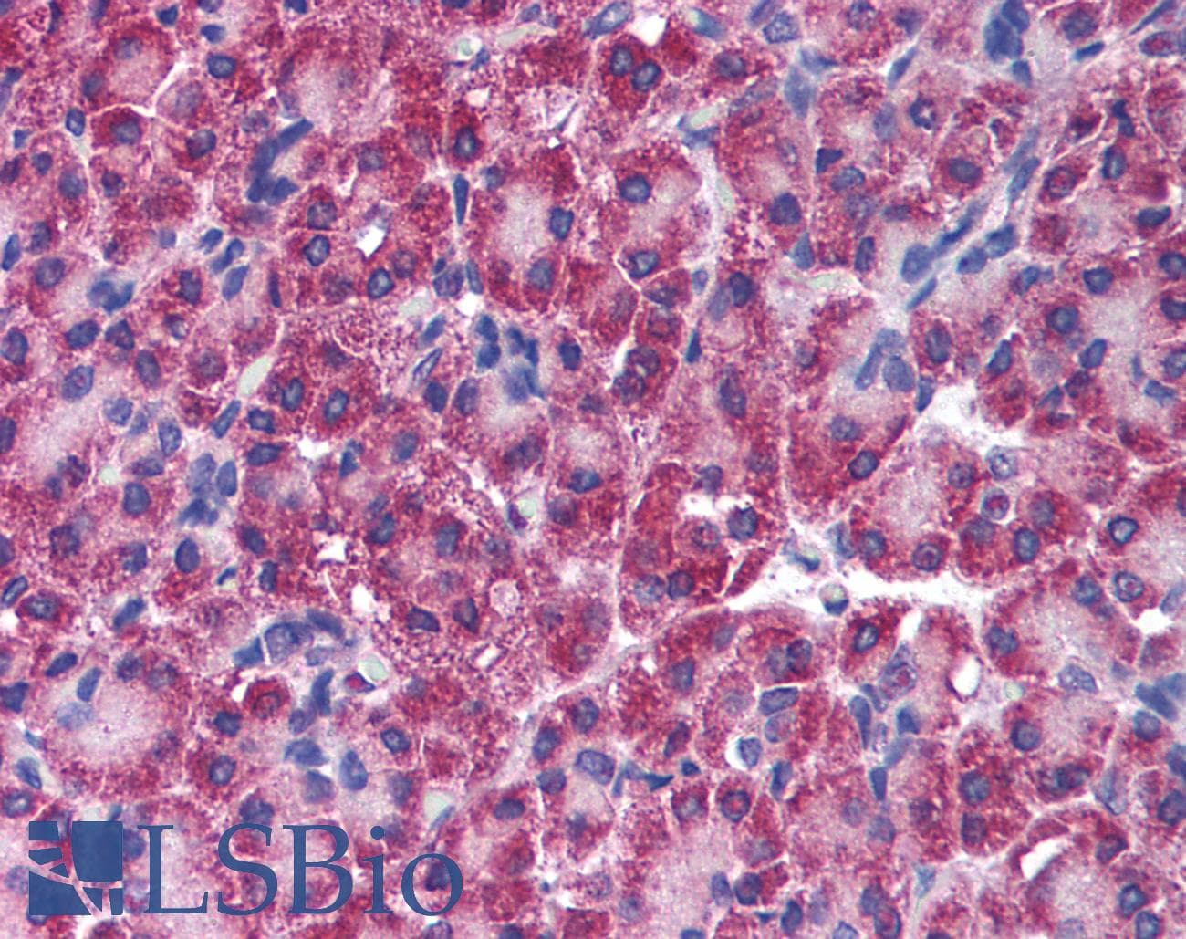 IHC-plus™ Polyclonal Rabbit anti-Human RICK / RIP2 Antibody (IHC, IF, WB)