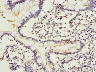 Polyclonal Rabbit anti-Human ARL6IP1 / ARMER Antibody (IHC)