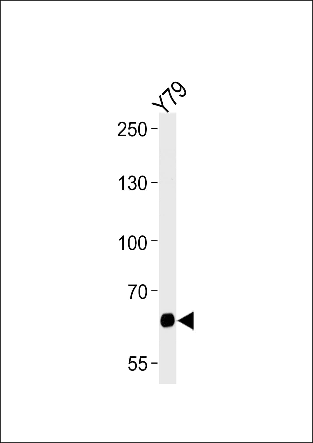 PPEF2 Antibody (aa304-333)