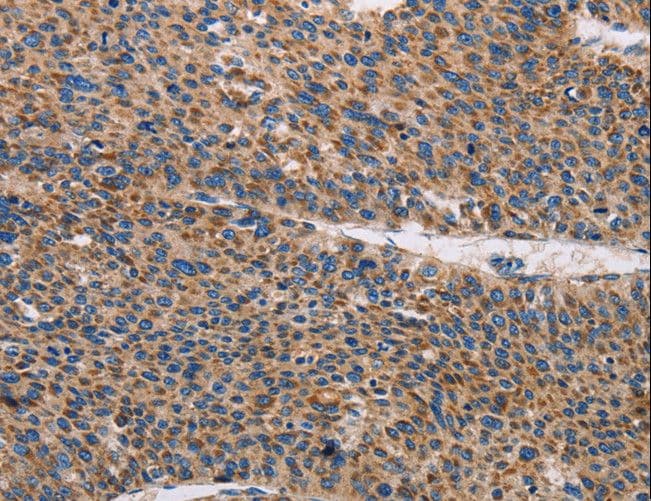 TLR8 Antibody