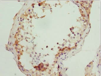 RUFY2 Antibody