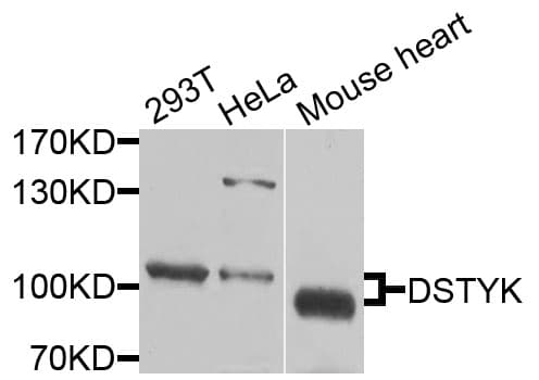 Polyclonal Rabbit anti-Human DSTYK / RIPK5 Antibody (WB)