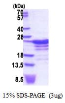 Human RBM18 Protein (Recombinant His)