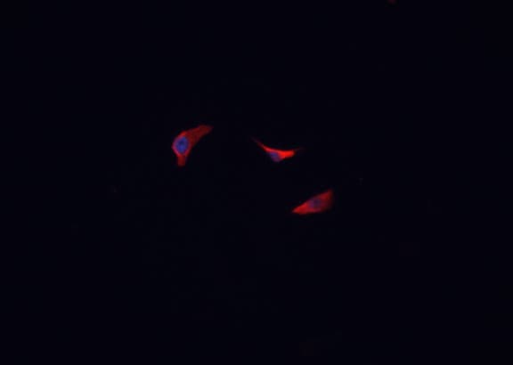 BCKDK Antibody