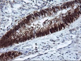 CMPK / CMPK1 Antibody (clone OTI1H8)