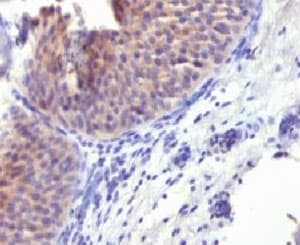 KRT10 / CK10 / Cytokeratin 10 Antibody (clone CTKN10-1)