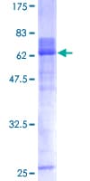 Human HOXA1 Protein (Recombinant GST)