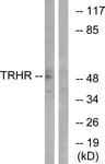 TRH Receptor / TRHR Antibody (aa195-244)