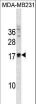 ANKRD37 Antibody (aa129-157)