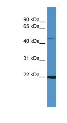GLOD2 / MCEE Antibody (aa105-154)
