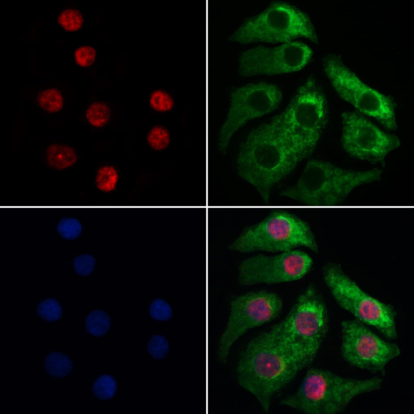 Polyclonal Rabbit anti-Human XAB2 Antibody (IF, WB)