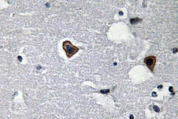 Polyclonal Rabbit anti-Human SGCB / SGC / Sarcoglycan Beta Antibody (aa87-136, IHC, WB)