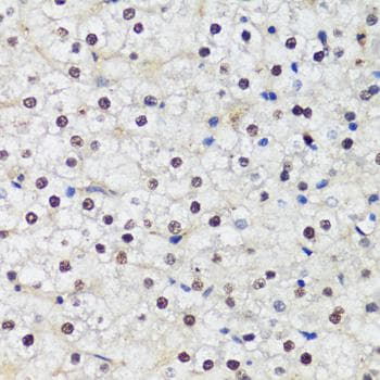 DNMT / DNMT1 Antibody