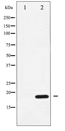 Polyclonal Rabbit anti-Human PPP1R14A / CPI-17 Antibody (phospho-Thr38, IHC, WB)