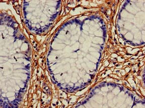 RALDH2 / ALDH1A2 Antibody