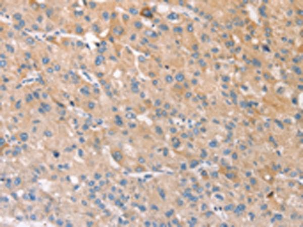 Polyclonal Rabbit anti-Human STK16 Antibody (IHC, WB)
