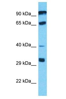 Polyclonal Rabbit anti-Human PGBD4 Antibody (aa535-584, WB)