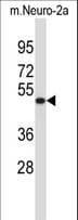 VAT1L Antibody (aa391-419)