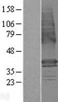 LMBR1 Protein (Over-Expression Lysate Myc-DDK (Flag))