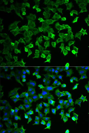 IHC-plus™ Polyclonal Rabbit anti-Human Heat Shock Protein 70 / HSPA1A Antibody (IHC, IF, WB)