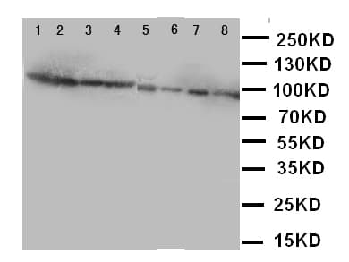 F8 / FVIII / Factor VIII Antibody (aa1264-1278)