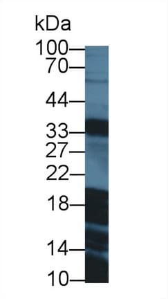 GAL / Galanin Antibody (aa32-122)