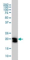 IHC-plus™ RHOA Antibody (clone 1C1)