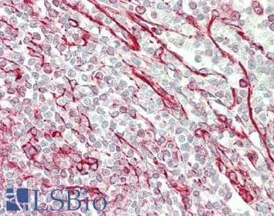 IHC-plus™ CHRM4 / M4 Antibody (210-290 aa, Internal)