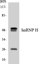HNRNPH2 / hnRNP H2 Antibody (aa143-192)