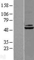 DBT / E2 Protein (Over-Expression Lysate Myc-DDK (Flag))