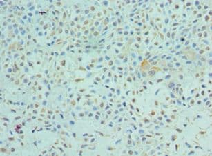 ETV6 / TEL Antibody (aa1-300)