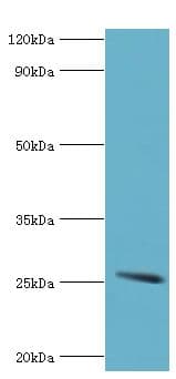 Polyclonal Rabbit anti-Human GSTA2 Antibody (aa1-222, IHC, WB)