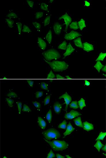 PSG1 / CD66f Antibody
