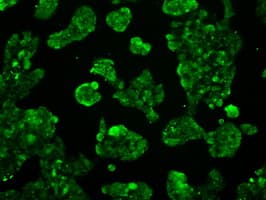 ATP5B / ATP Synthase Beta Antibody (clone OTI9E3, Carrier-free)