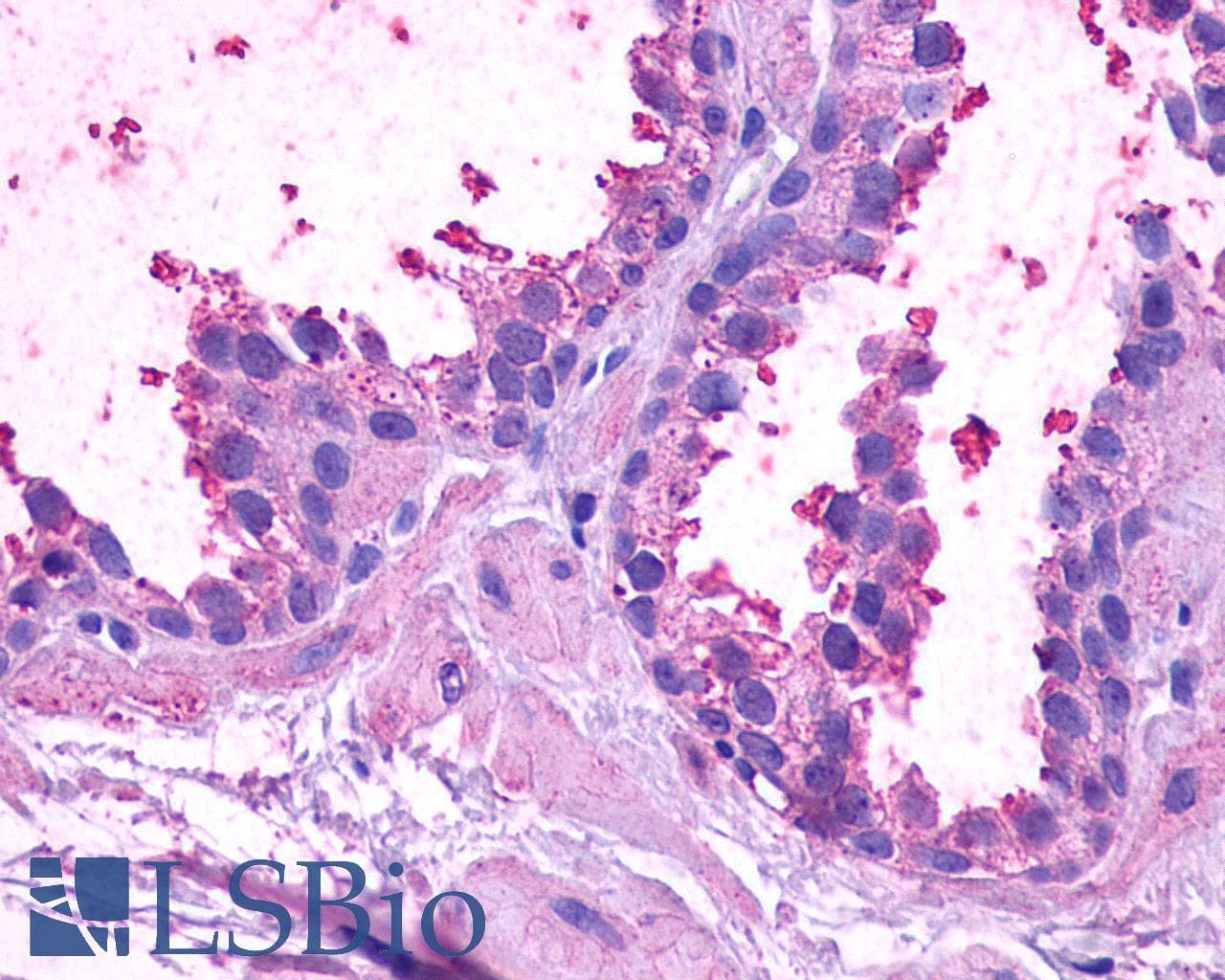 IHC-plus™ ADGRB1 / BAI1 Antibody (C-Terminus)
