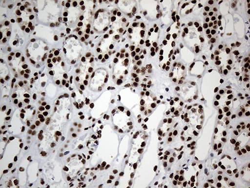 HNRNPH1 / hnRNP H Antibody (clone OTI2E8)