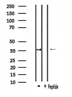 Polyclonal Rabbit anti-Human CACNG7 Antibody (IF, WB)