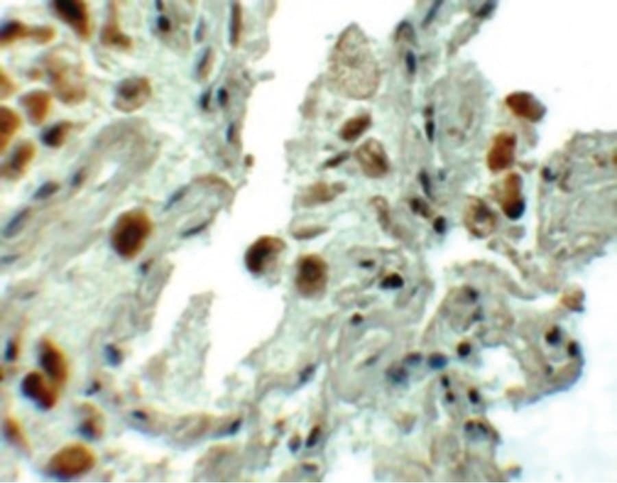 SPTLC1 / HSN1 Antibody