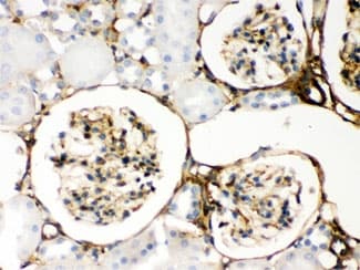 Polyclonal Rabbit anti-Human LGALS1 / Galectin 1 Antibody (IHC, WB)