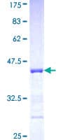 Human PCDHA5 Protein (Recombinant GST, N-terminus)