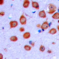 OLFML2A Antibody (Internal)