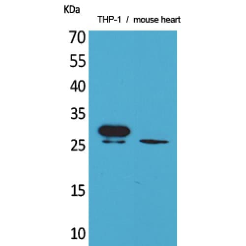 Polyclonal Rabbit anti-Human TREM1 Antibody (40-120 aa, Internal, WB)